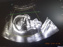 R1250531